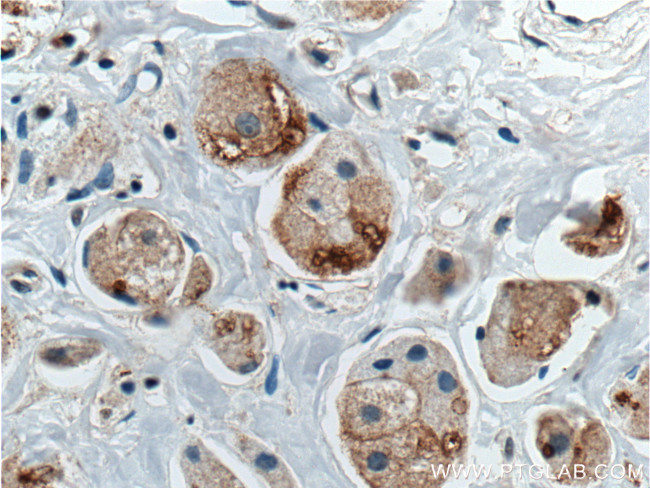 DVL1 Antibody in Immunohistochemistry (Paraffin) (IHC (P))