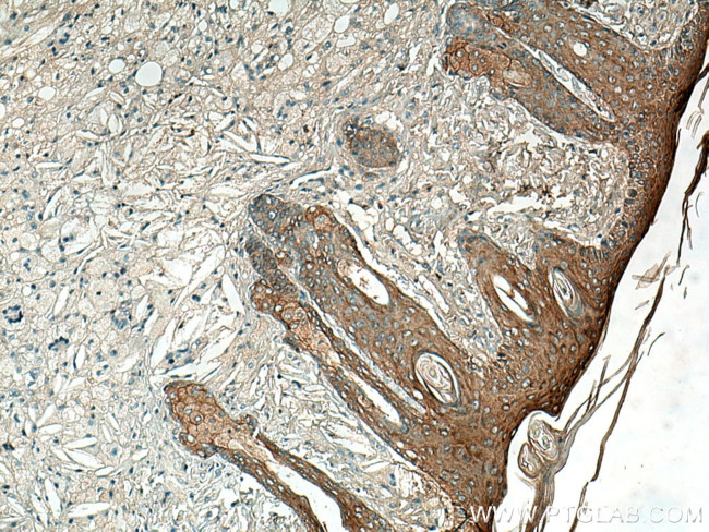 ABI1 Antibody in Immunohistochemistry (Paraffin) (IHC (P))