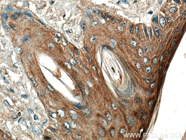 ABI1 Antibody in Immunohistochemistry (Paraffin) (IHC (P))