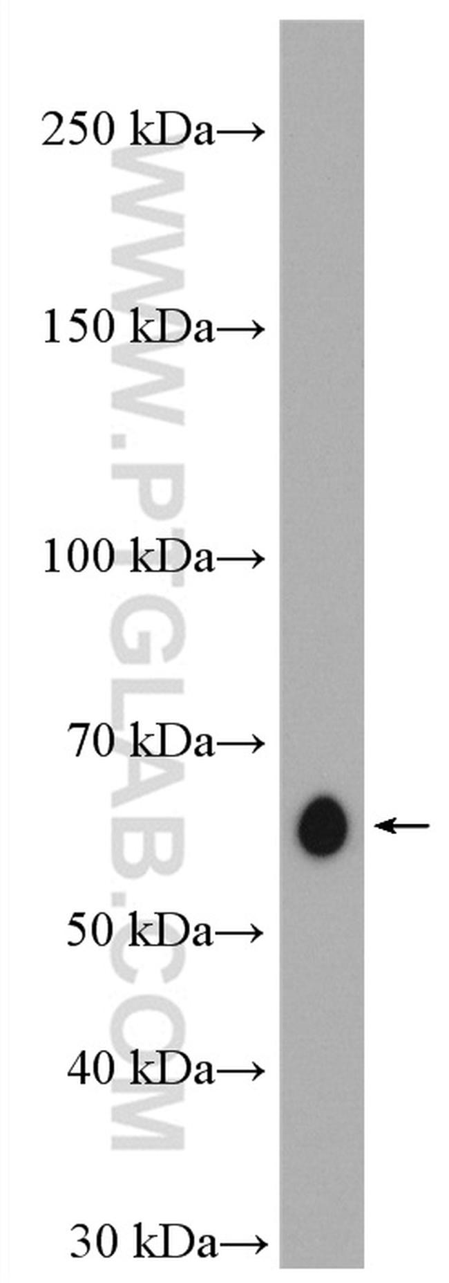 ABI1 Antibody in Western Blot (WB)