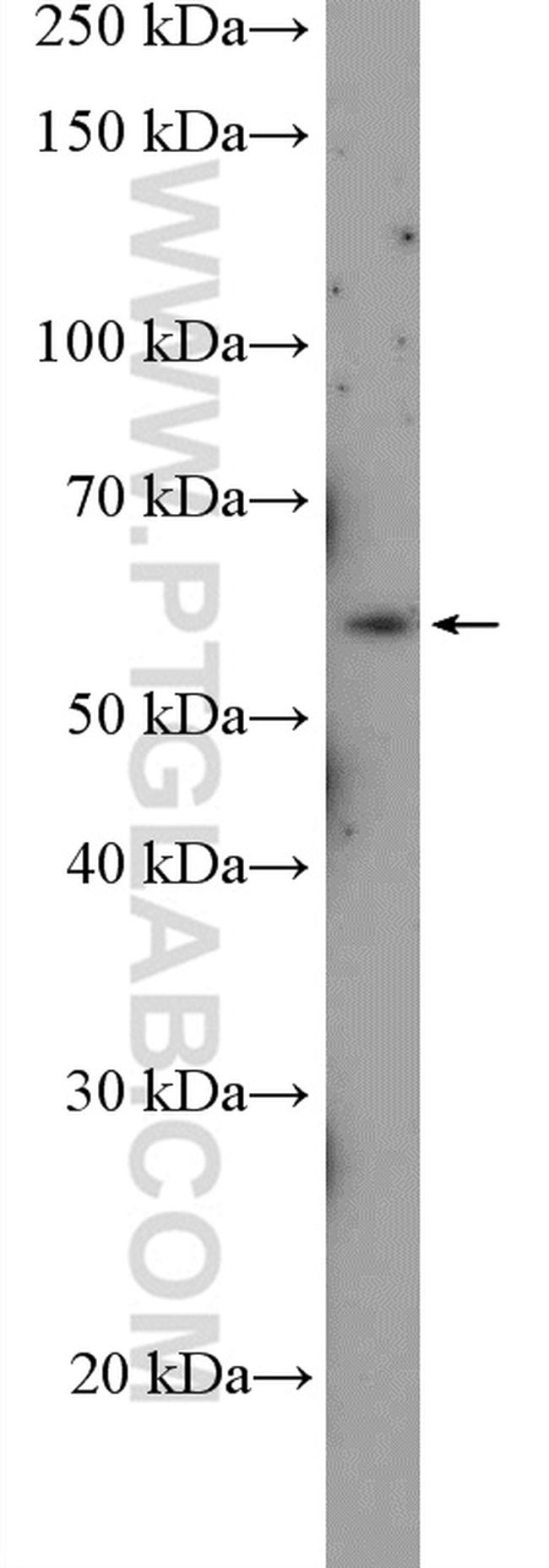 ABI1 Antibody in Western Blot (WB)