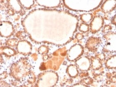 Glyoxalase 1 (GLO1) Antibody in Immunohistochemistry (Paraffin) (IHC (P))