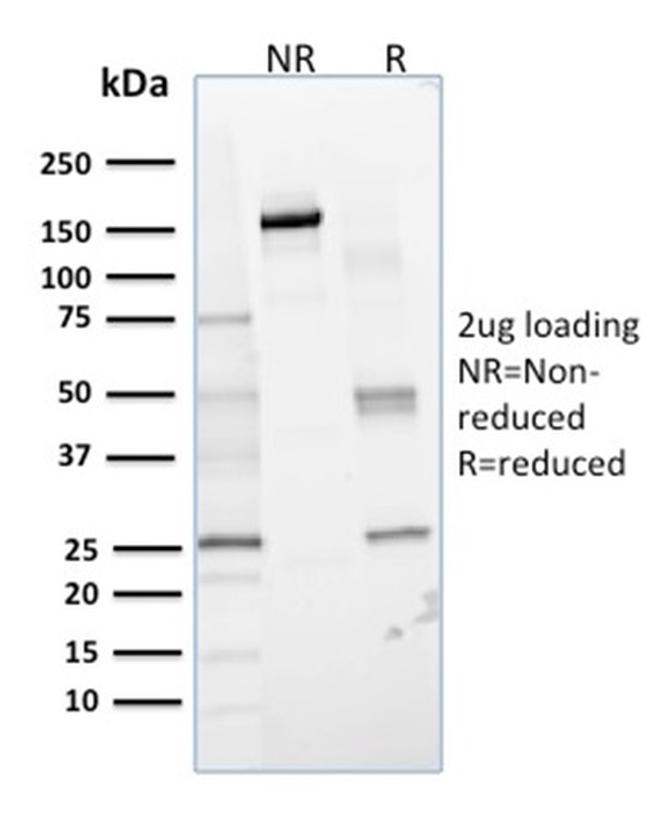 Glyoxalase 1 (GLO1) Antibody in SDS-PAGE (SDS-PAGE)