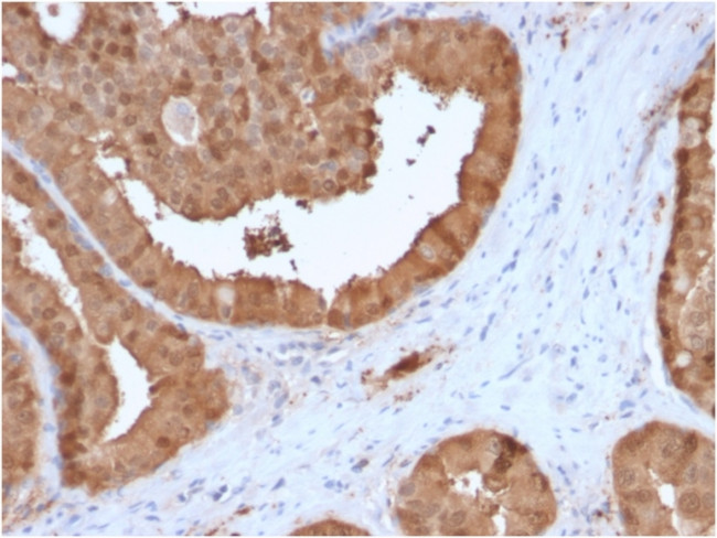 Glyoxalase 1 (GLO1) Antibody in Immunohistochemistry (Paraffin) (IHC (P))