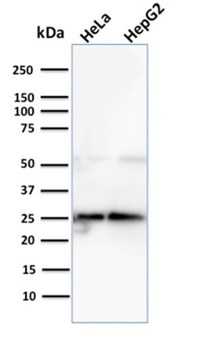 Glyoxalase 1 (GLO1) Antibody in Western Blot (WB)