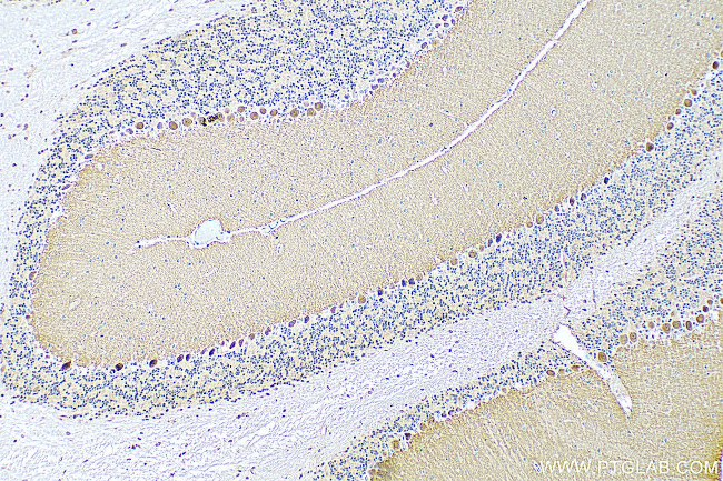 RGS8 Antibody in Immunohistochemistry (Paraffin) (IHC (P))