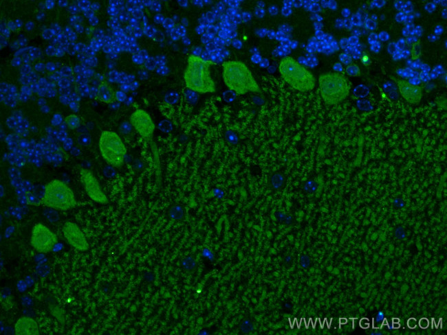 RGS8 Antibody in Immunohistochemistry (PFA fixed) (IHC (PFA))