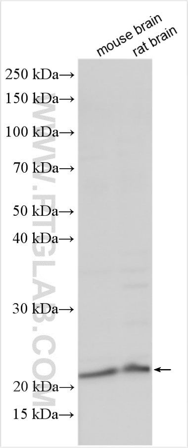 RGS8 Antibody in Western Blot (WB)