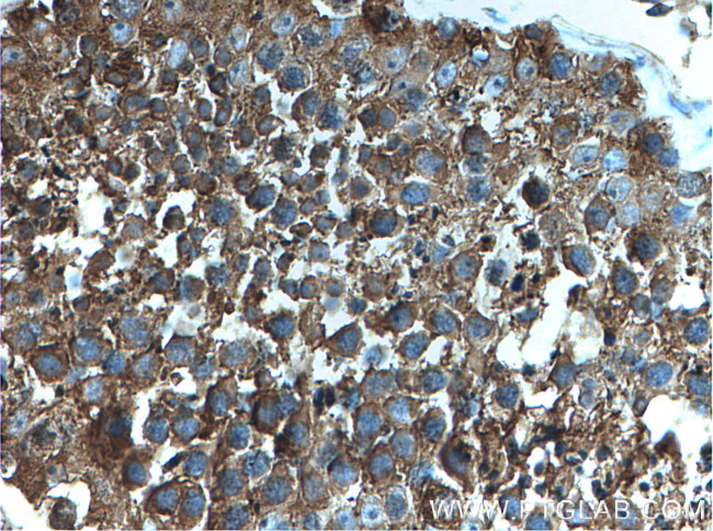 PRKACA Antibody in Immunohistochemistry (Paraffin) (IHC (P))