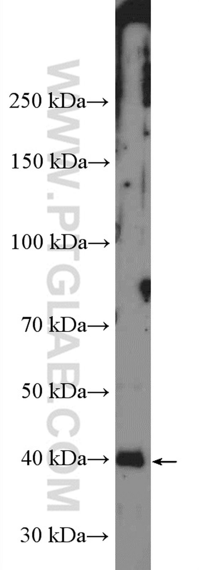 PRKACA Antibody in Western Blot (WB)