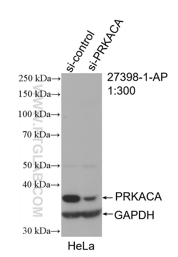 PRKACA Antibody in Western Blot (WB)