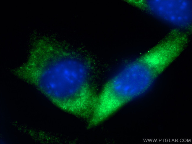 RAB5B Antibody in Immunocytochemistry (ICC/IF)