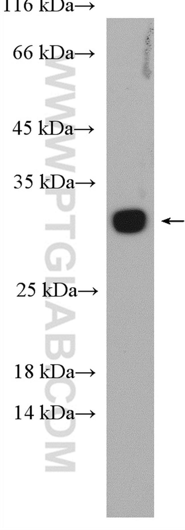 RAB5B Antibody in Western Blot (WB)