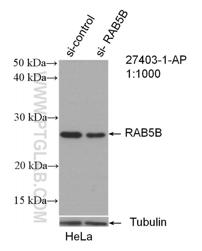 RAB5B Antibody in Western Blot (WB)