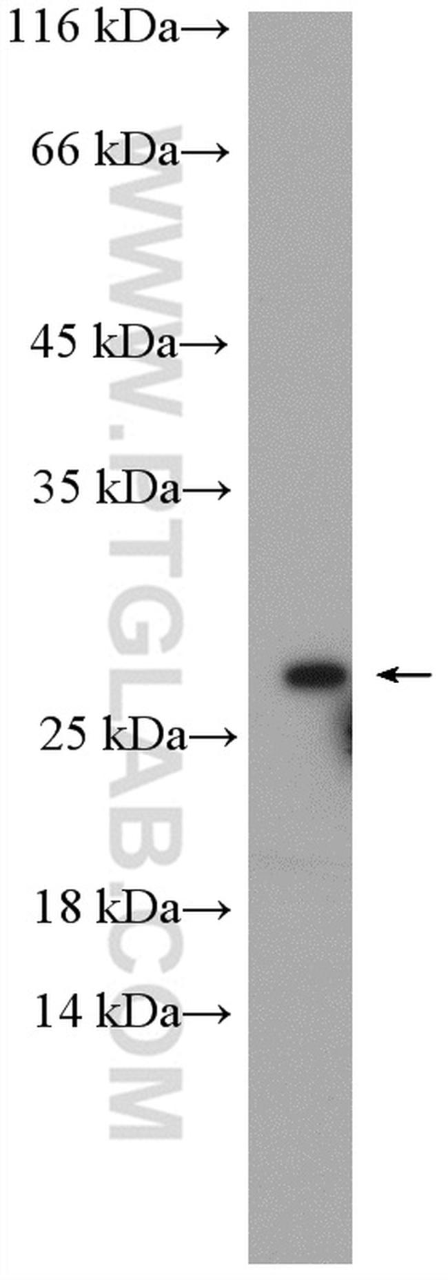 RAB5B Antibody in Western Blot (WB)