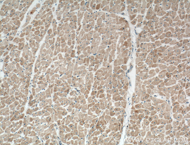 NPPA Antibody in Immunohistochemistry (Paraffin) (IHC (P))