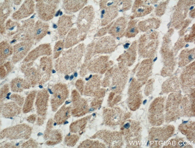 NPPA Antibody in Immunohistochemistry (Paraffin) (IHC (P))