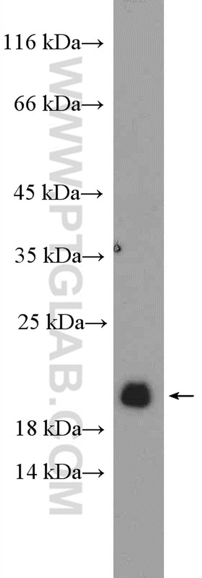 NPPA Antibody in Western Blot (WB)