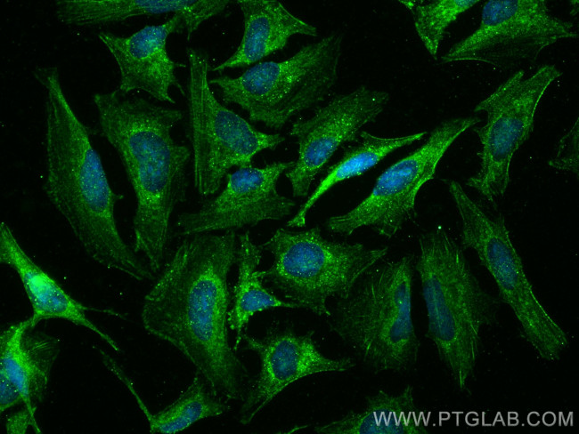 NODAL Antibody in Immunocytochemistry (ICC/IF)