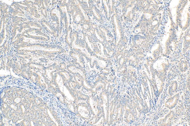 NODAL Antibody in Immunohistochemistry (Paraffin) (IHC (P))