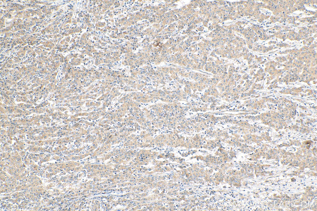 NODAL Antibody in Immunohistochemistry (Paraffin) (IHC (P))