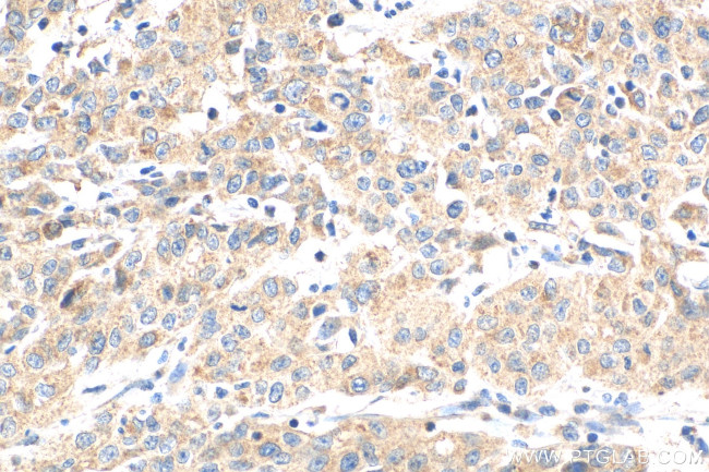 NODAL Antibody in Immunohistochemistry (Paraffin) (IHC (P))