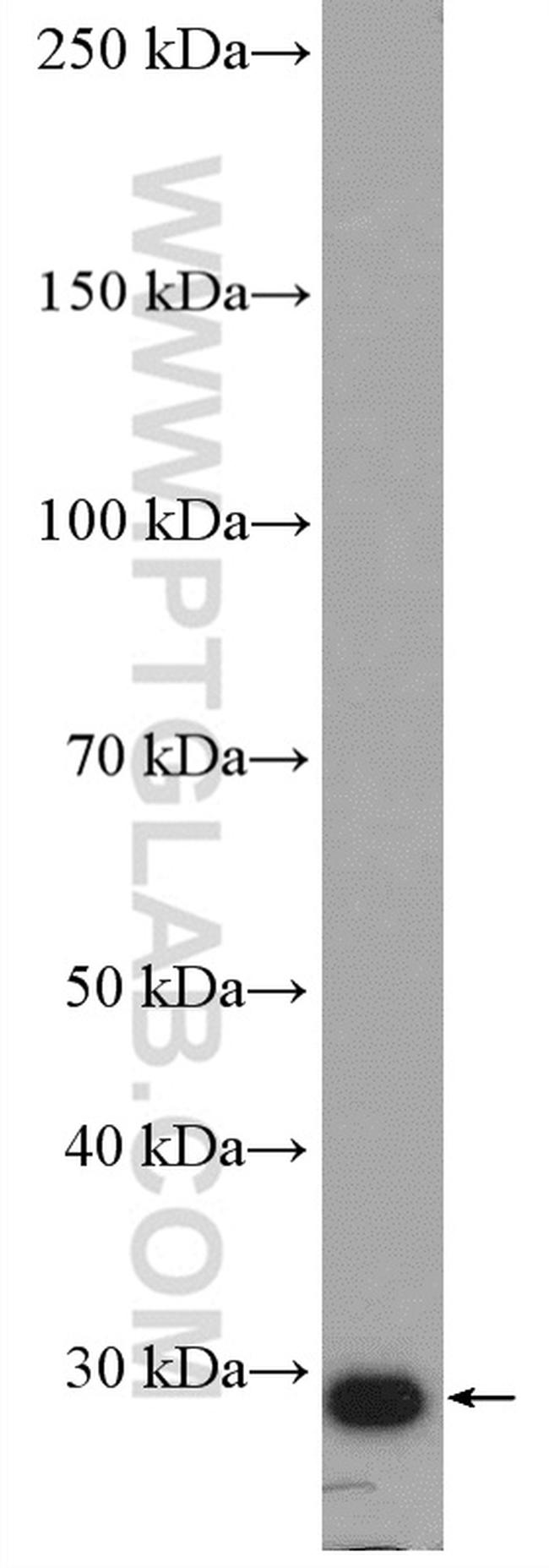 RAB34 Antibody in Western Blot (WB)