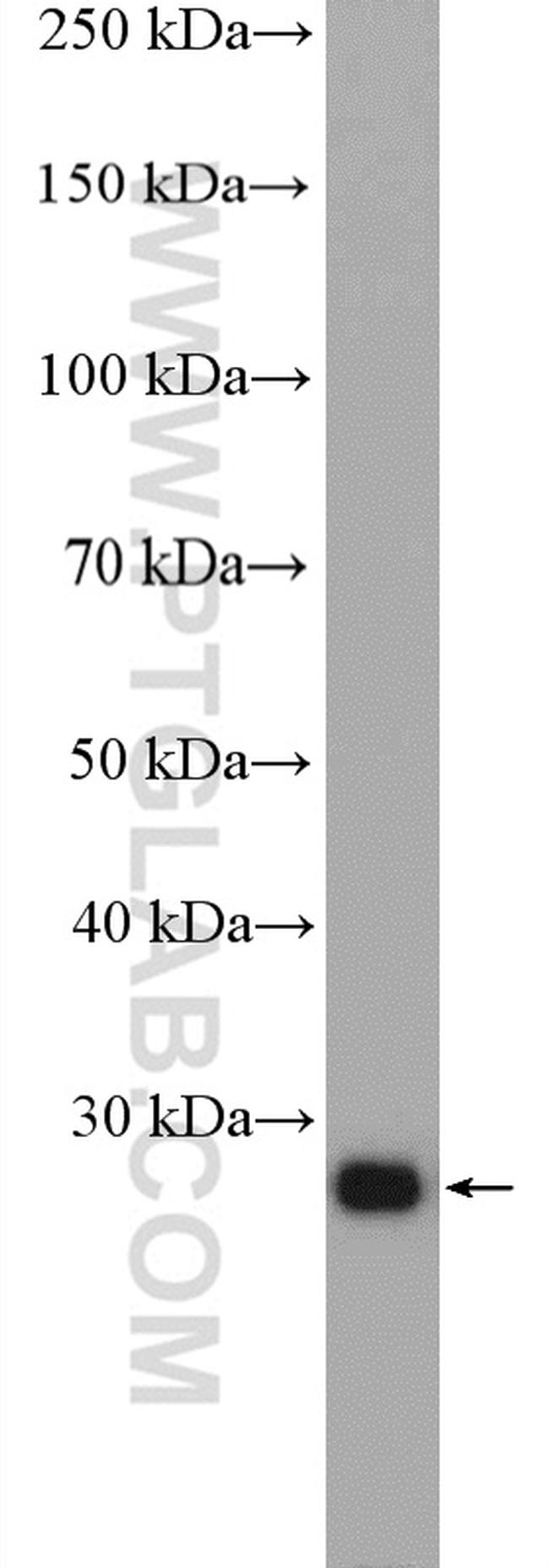 RAB34 Antibody in Western Blot (WB)