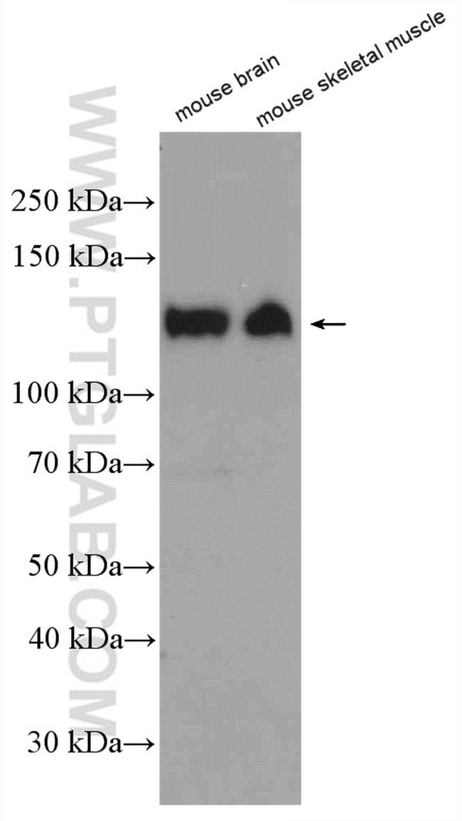 CACNA2D1 Antibody in Western Blot (WB)