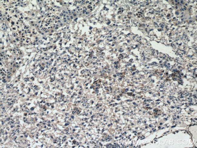 GDF15 Antibody in Immunohistochemistry (Paraffin) (IHC (P))