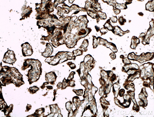 GDF15 Antibody in Immunohistochemistry (Paraffin) (IHC (P))