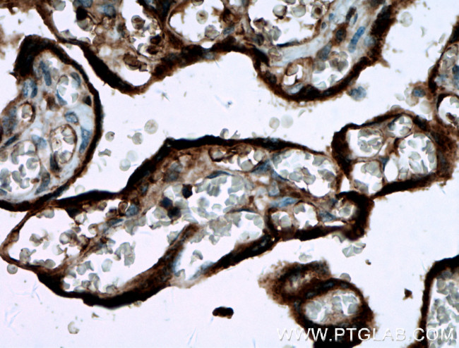 GDF15 Antibody in Immunohistochemistry (Paraffin) (IHC (P))