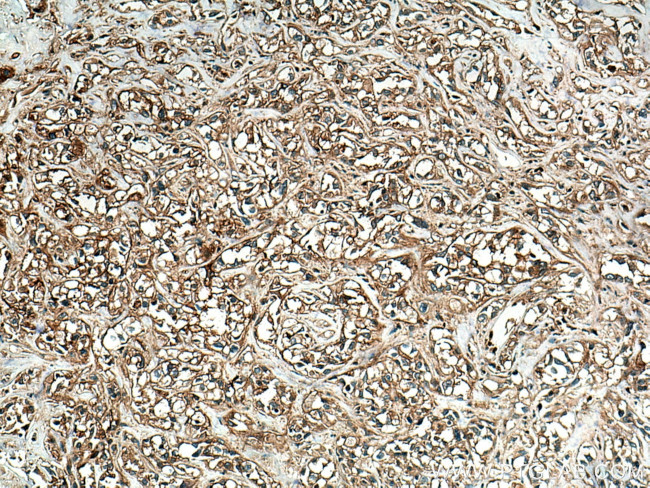 RRAS Antibody in Immunohistochemistry (Paraffin) (IHC (P))