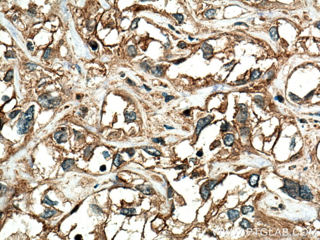 RRAS Antibody in Immunohistochemistry (Paraffin) (IHC (P))