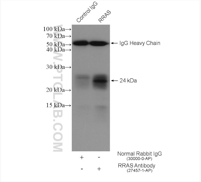 RRAS Antibody in Immunoprecipitation (IP)