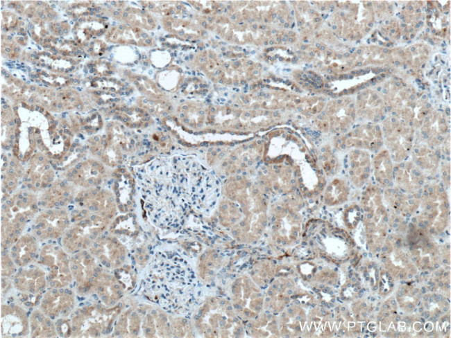 Kininogen 1 Antibody in Immunohistochemistry (Paraffin) (IHC (P))