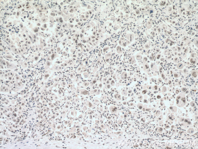 NDNL2 Antibody in Immunohistochemistry (Paraffin) (IHC (P))