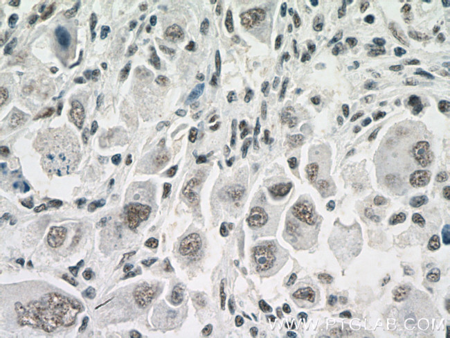 NDNL2 Antibody in Immunohistochemistry (Paraffin) (IHC (P))