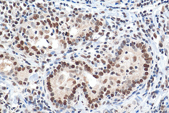 GTF3C2 Antibody in Immunohistochemistry (Paraffin) (IHC (P))