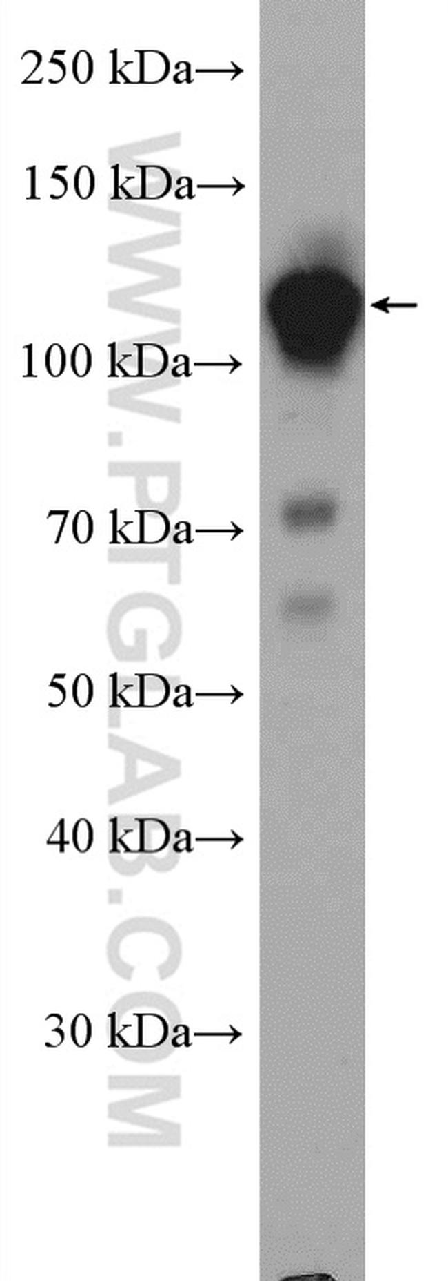 GTF3C2 Antibody in Western Blot (WB)