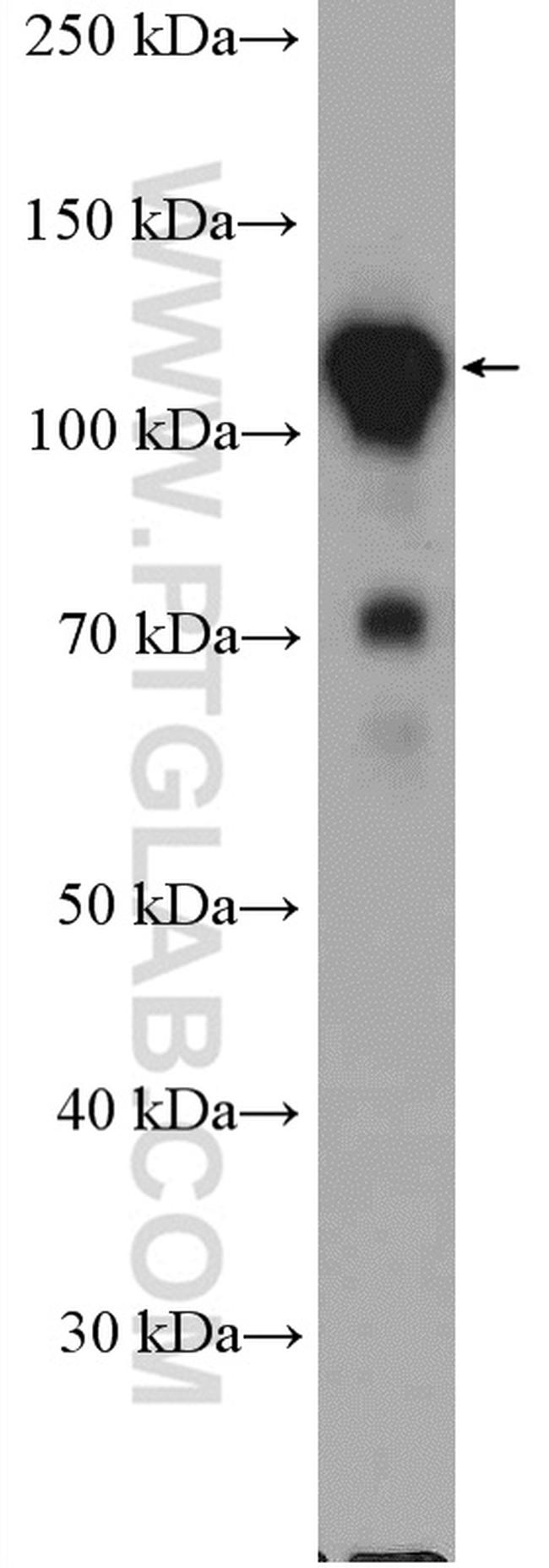 GTF3C2 Antibody in Western Blot (WB)