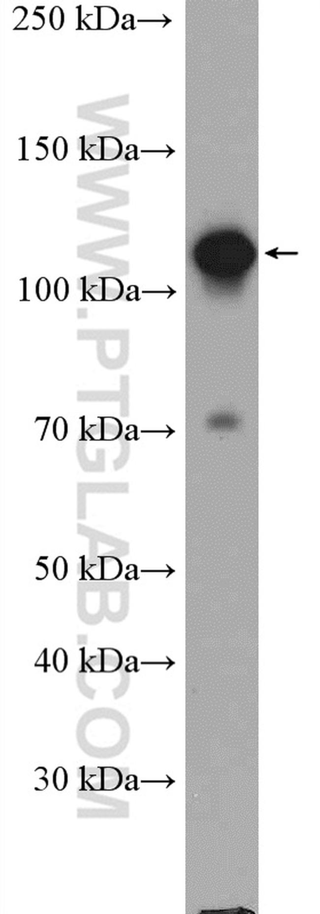 GTF3C2 Antibody in Western Blot (WB)