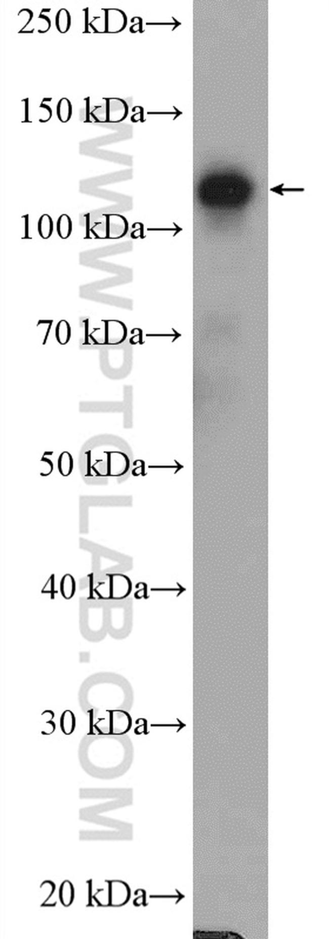 GTF3C2 Antibody in Western Blot (WB)