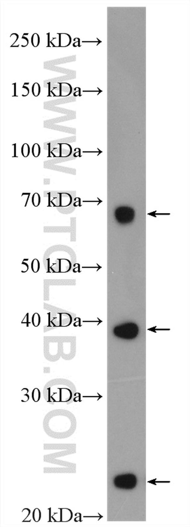 SLC31A1 Antibody in Western Blot (WB)