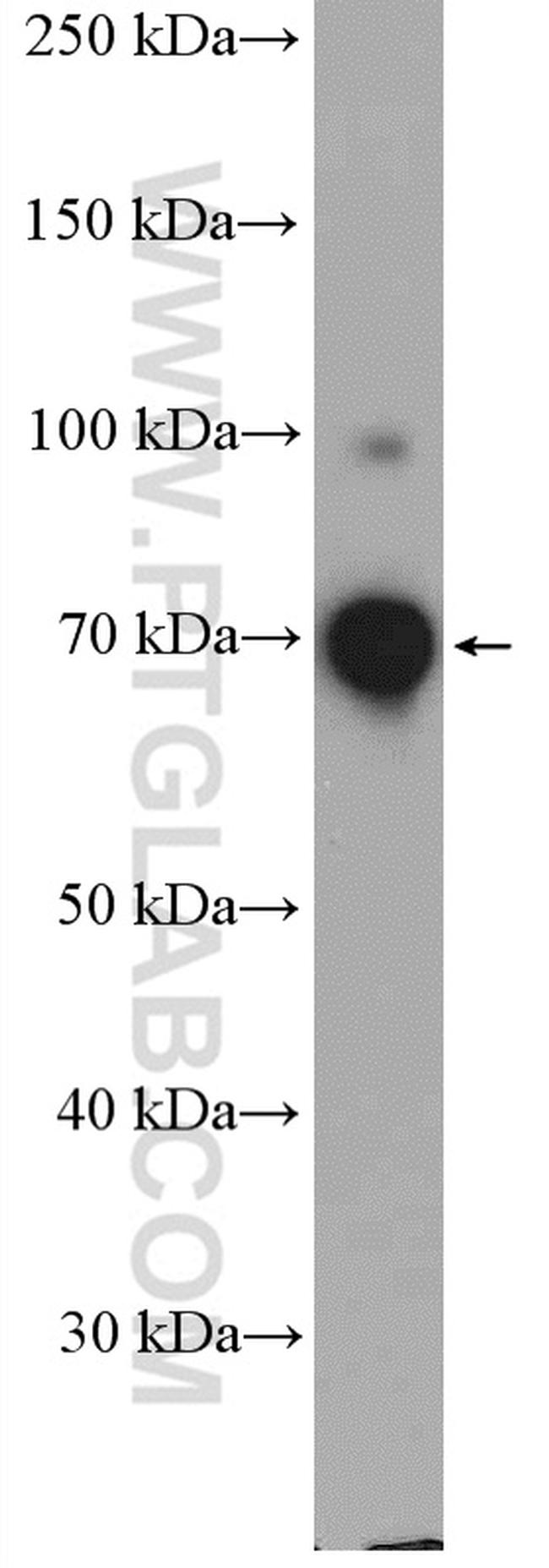 DDX41 Antibody in Western Blot (WB)