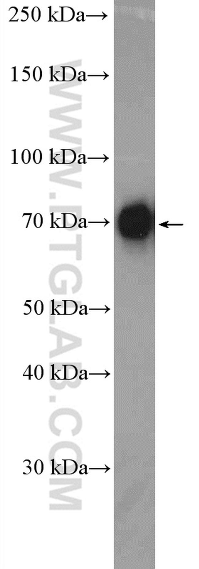 DDX41 Antibody in Western Blot (WB)