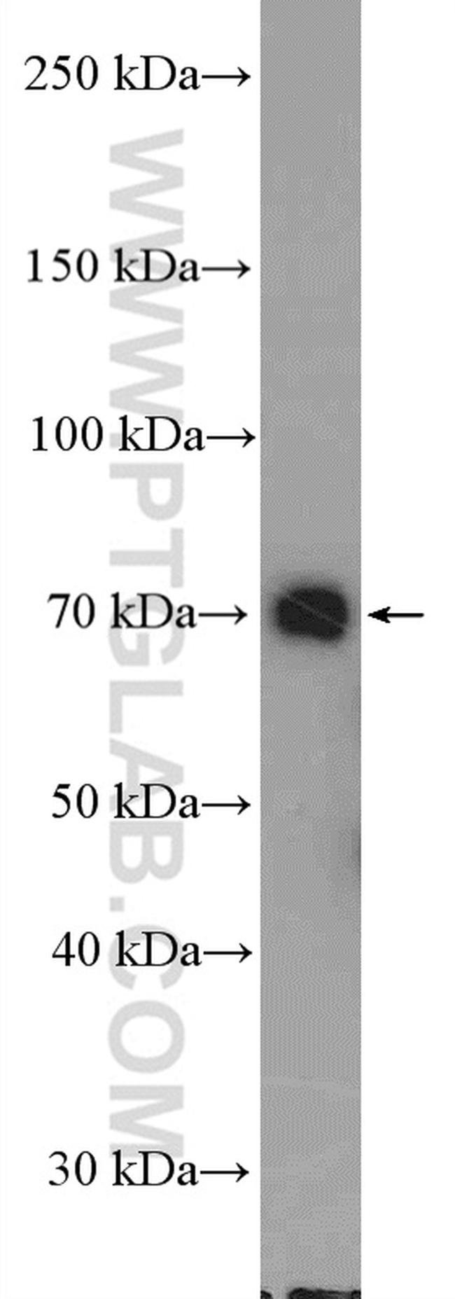 DDX41 Antibody in Western Blot (WB)