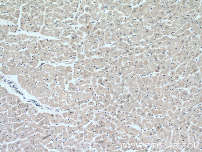 MOCS3 Antibody in Immunohistochemistry (Paraffin) (IHC (P))