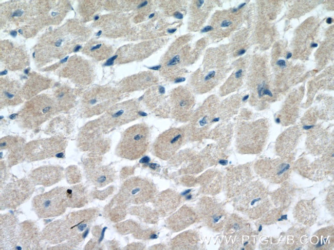 MOCS3 Antibody in Immunohistochemistry (Paraffin) (IHC (P))