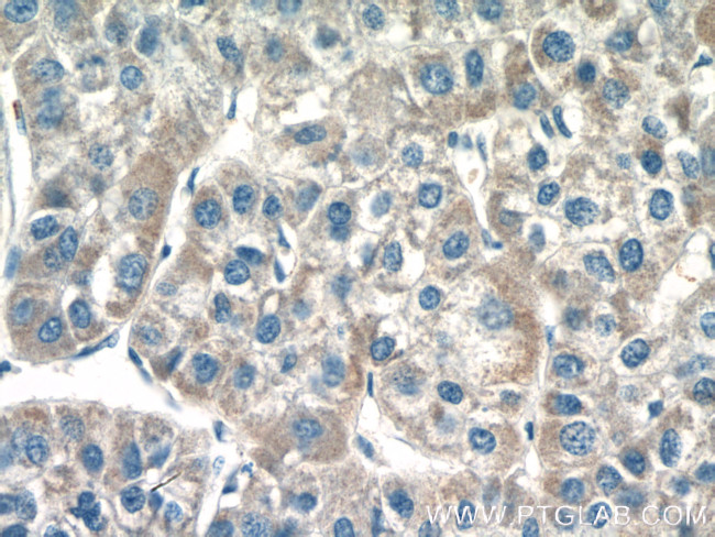 MOCS3 Antibody in Immunohistochemistry (Paraffin) (IHC (P))